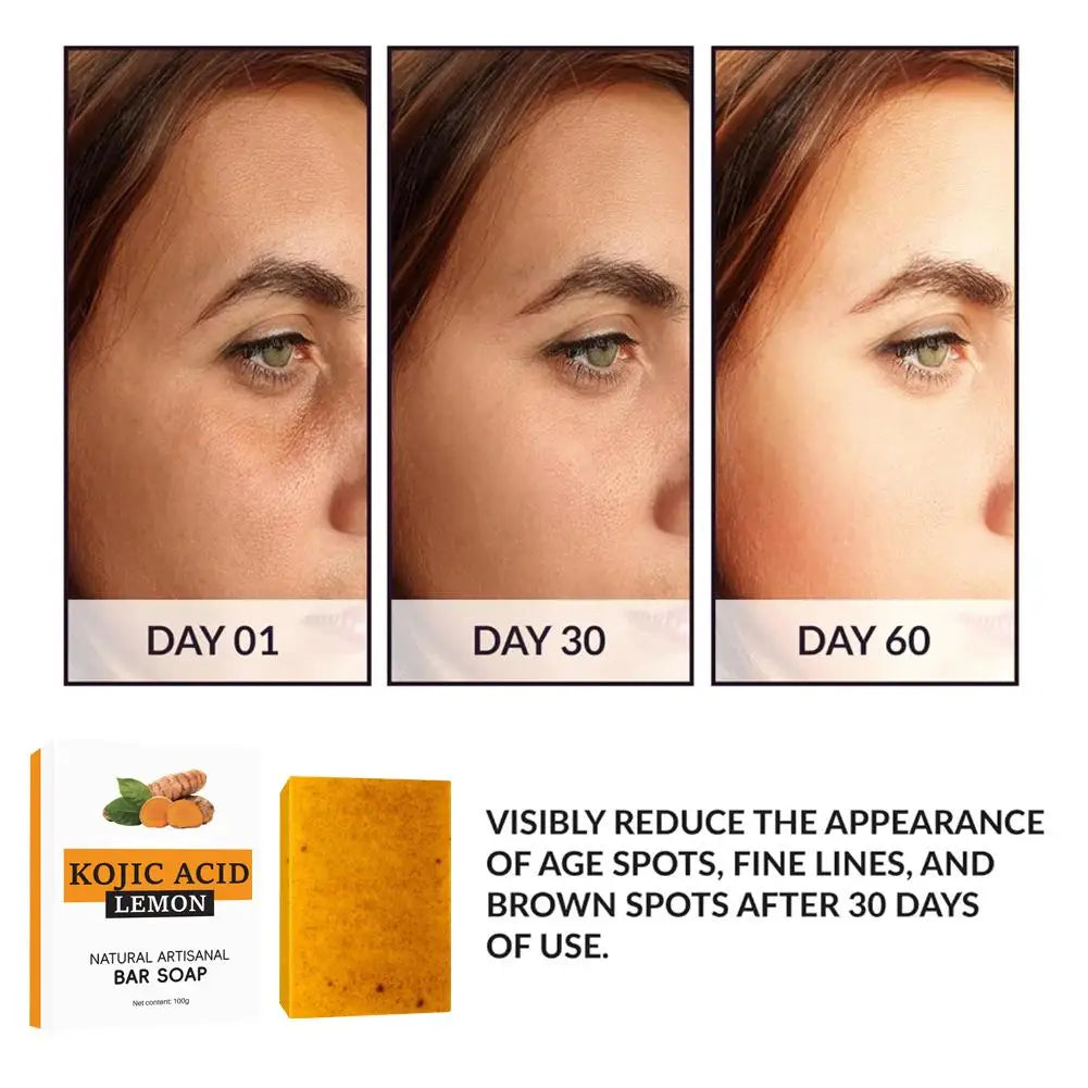 Turmeric & Ginger Handmade Soap – Anti-Acne, Brightening & Skin Lightening