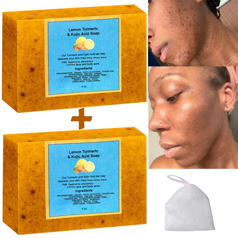 2pcs Turmeric & Lemon Soap – Brightening, Acne-Fighting & Skin Toning for Face & Body